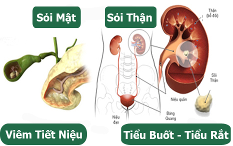 Trị Bệnh Thận - Tiết Niệu